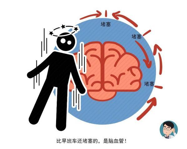 腦中風發(fā)作前的四個癥狀 謹防中風猝死 腦中風發(fā)作前的四個癥狀 謹防中風猝死